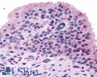 PathPlus™ FZD5 / Frizzled 5 Antibody (N-Terminus)