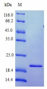Human IFNW1 Protein (Recombinant)
