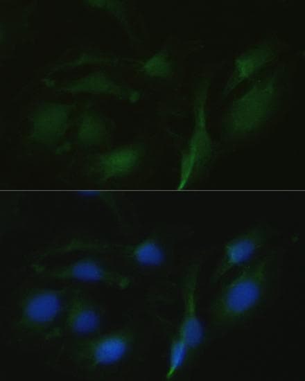 VR1 / TRPV1 Antibody