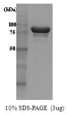 Saccharomyces cerevisiae HSP104 Protein (Recombinant)