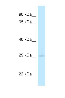 Polyclonal Rabbit anti-Mouse 4933408B17Rik Antibody (aa200-249, WB)