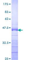 Human DP97 / DDX54 Protein (Recombinant GST, N-terminus)