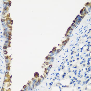 Polyclonal Rabbit anti-Human TNNC2 Antibody (IHC, WB)