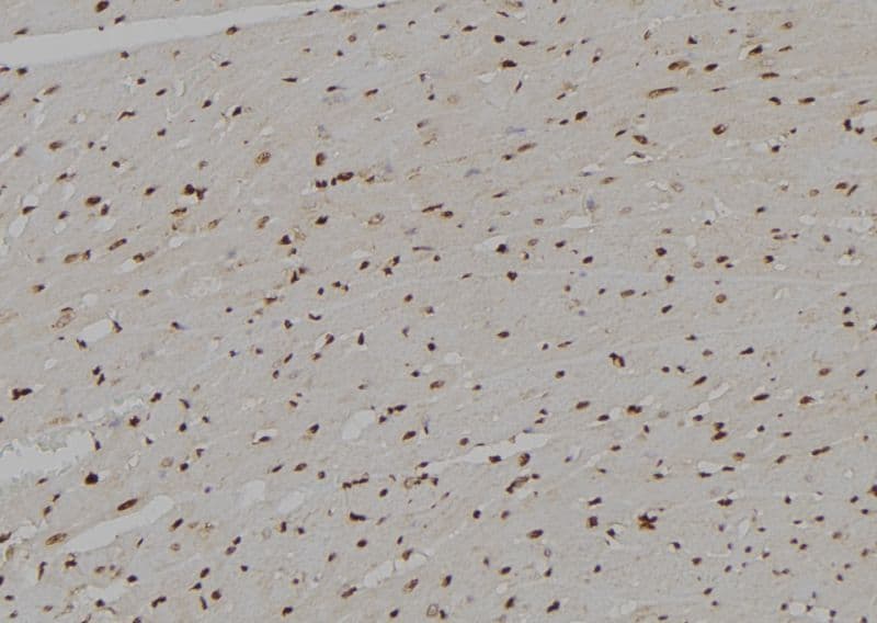 FE65L1 / APBB2 Antibody