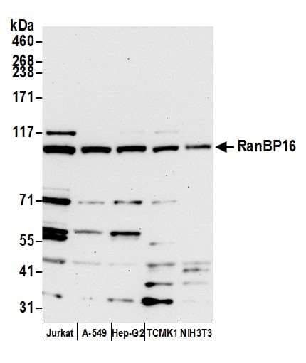 Polyclonal Rabbit anti-Human XPO7 / RANBP16 Antibody (aa1-50, WB)