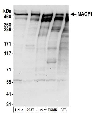 MACF1 Antibody (aa1975-2025)