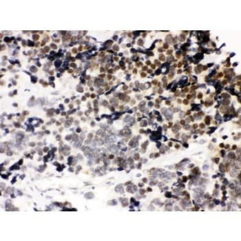CTCF Antibody (aa521-727)