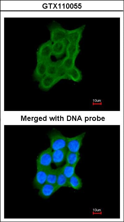 Polyclonal Rabbit anti-Human CRTAP Antibody (aa122-363, WB)