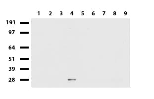 MMP7 / Matrilysin Antibody (aa95-267, clone UMAB168)