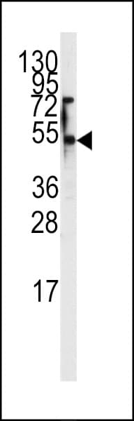 IHC-plus™ Polyclonal Rabbit anti-Human SLC29A1 / ENT1 Antibody (Ser254, IHC, WB)