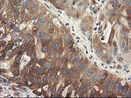 BCAR1 / p130Cas Antibody (clone OTI1B1)
