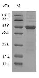 Human ADTRP / C6orf105 Protein (Recombinant 10His-SUMO, N-terminus + Myc, C-terminus)
