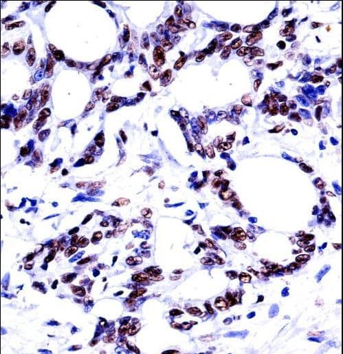 Polyclonal Rabbit anti-Human HNRPM / HNRNPM Antibody (aa21-50, IHC, WB)