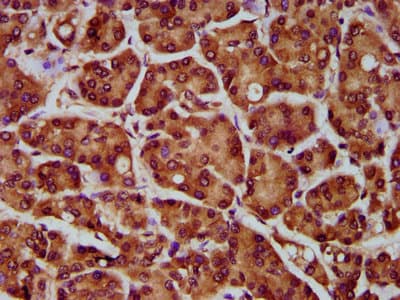 MOGAT1 / MGAT1 Antibody