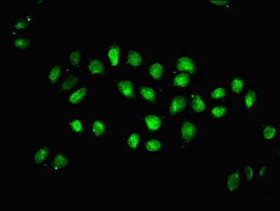 Polyclonal Rabbit anti-Human HIST1H1C Antibody (WB)
