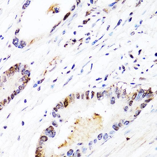 Polyclonal Rabbit anti-Human FGF12 Antibody (IHC)