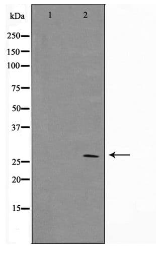BCL2 / Bcl-2 Antibody