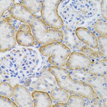 Polyclonal Rabbit anti-Human ARFGAP1 Antibody (IHC, IF, WB)