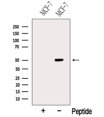STARD3 / MLN64 Antibody