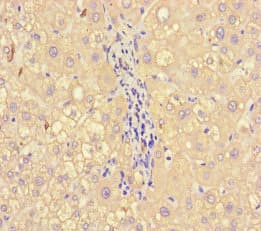 A2M / Alpha-2-Macroglobulin Antibody