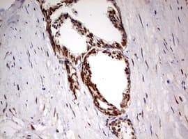 Monoclonal Mouse anti-Human TRIM24 / TIF1 Antibody (clone OTI2D9, aa706-1016, IHC, WB)