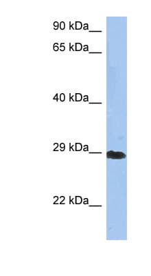 Polyclonal Rabbit anti-Human CRYBA1 Antibody (N-Terminus, WB)