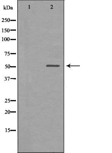 CHRNA5 Antibody