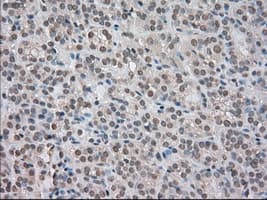 NTRK3 / TRKC Antibody (clone OTI2B8)