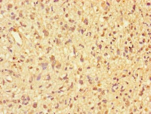 Polyclonal Rabbit anti-Human PPP2R2D Antibody (IHC, IF, WB)