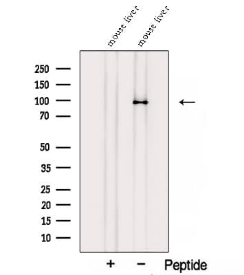 STRA6 Antibody (aa17-42)