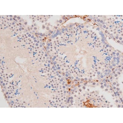 c-Kit / CD117 Antibody (phospho-Tyr703)