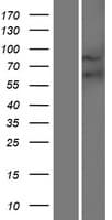 FZD9 / Frizzled 9 Protein (Over-Expression Lysate Myc-DDK (Flag))