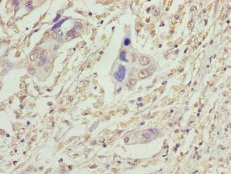 VPS25 Antibody