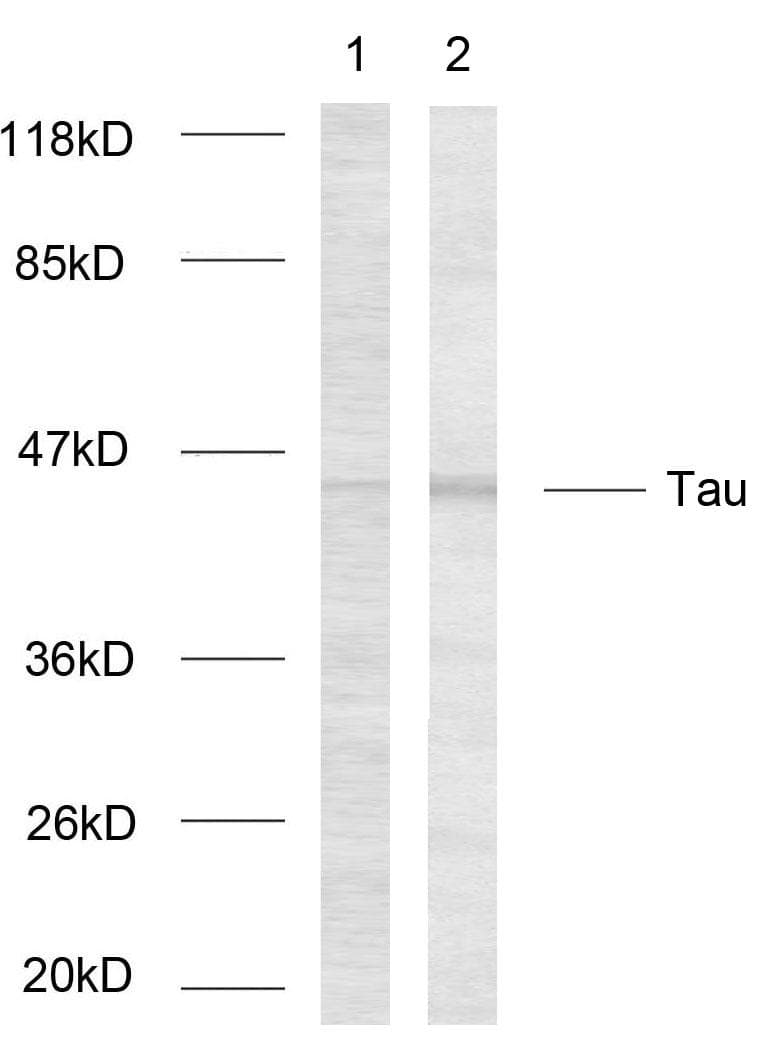 MAPT / Tau Antibody (p262)