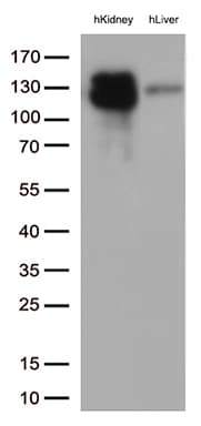 Monoclonal Mouse anti-Human MME / CD10 Antibody (clone UMAB236, Carrier-free, aa411-750, IHC, WB)