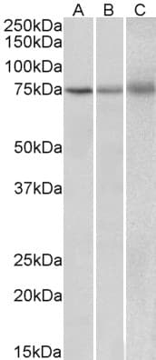 Polyclonal Goat anti-Human KLHL6 Antibody (aa306-319, WB)