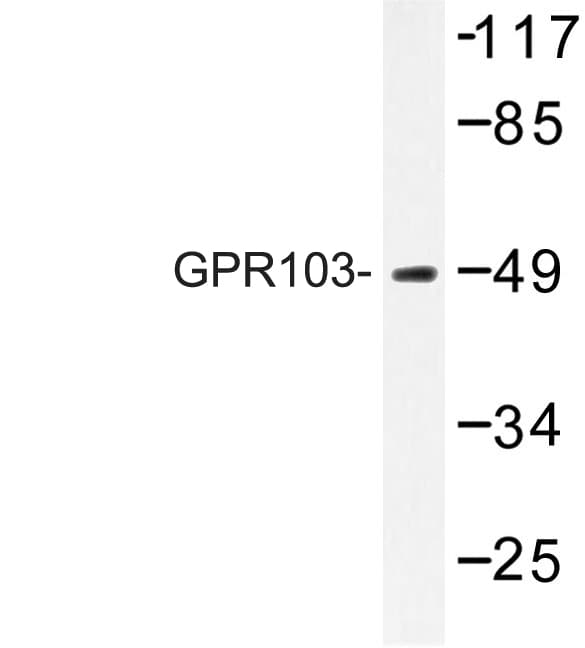 Polyclonal Rabbit anti-Human QRFPR / GPR103 Antibody (Ile310, IF, WB)