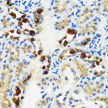 GABARAP Antibody