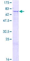 Human GLYCTK / Glycerate Kinase Protein (Recombinant GST)