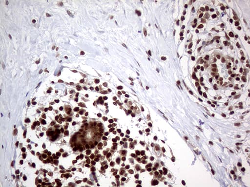 MGMT Antibody (clone OTI6G6)