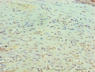 RBBP5 Antibody (aa319-538)