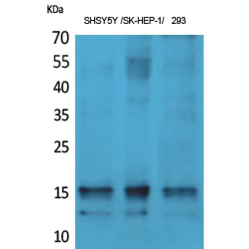 SNCA / Alpha-Synuclein Antibody (60-140 aa)