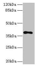 Polyclonal Rabbit anti-Human TMEM59L Antibody (IHC, WB)