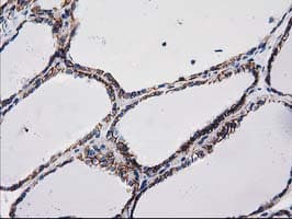 CTNNB1 / Beta Catenin Antibody (clone OTI9F6)