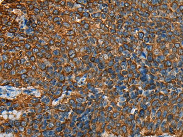 Polyclonal Rabbit anti-Human YBX1 / YB1 Antibody (IHC)