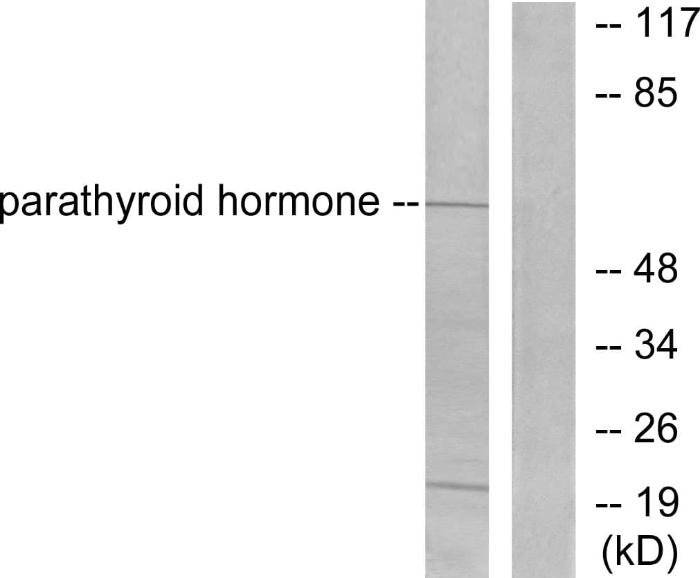 PTH / Parathyroid Hormone Antibody (aa51-100)