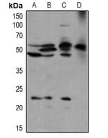 BLK Antibody