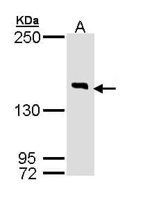 DIP2B Antibody (aa1168-1427)
