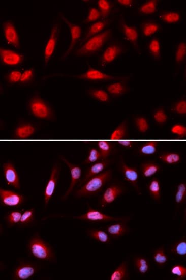 PDPK1 / PDK1 Antibody