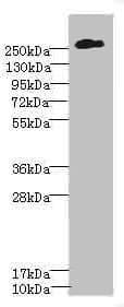 PathPlus™ Polyclonal Rabbit anti-Human CSPG4 / NG2 Antibody (IHC, WB)